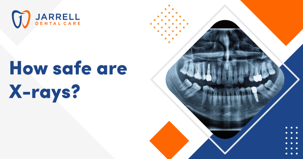 How safe are Xrays? Jarrell Dental Care