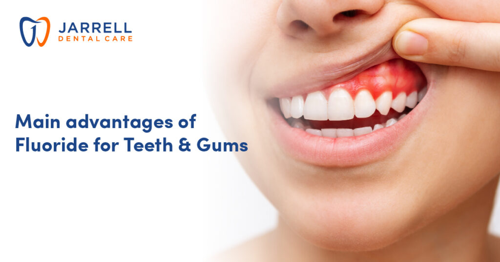 Main advantages of Fluoride for Teeth and Gums Jarrell Dental Care