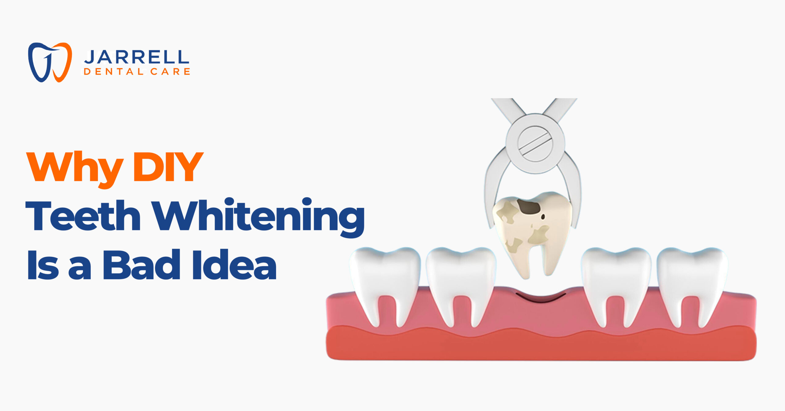 Why DIY Teeth Whitening Is a Bad Idea