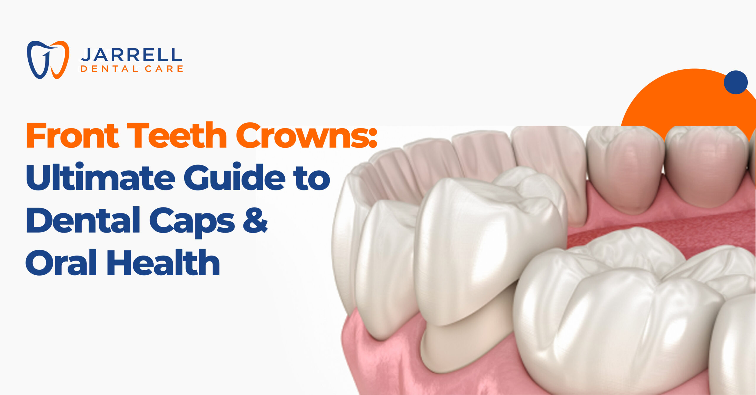 Front Teeth Crowns: Ultimate Guide to Dental Caps and Oral Health
