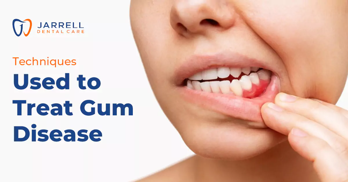 Techniques Used to Treat Gum Disease