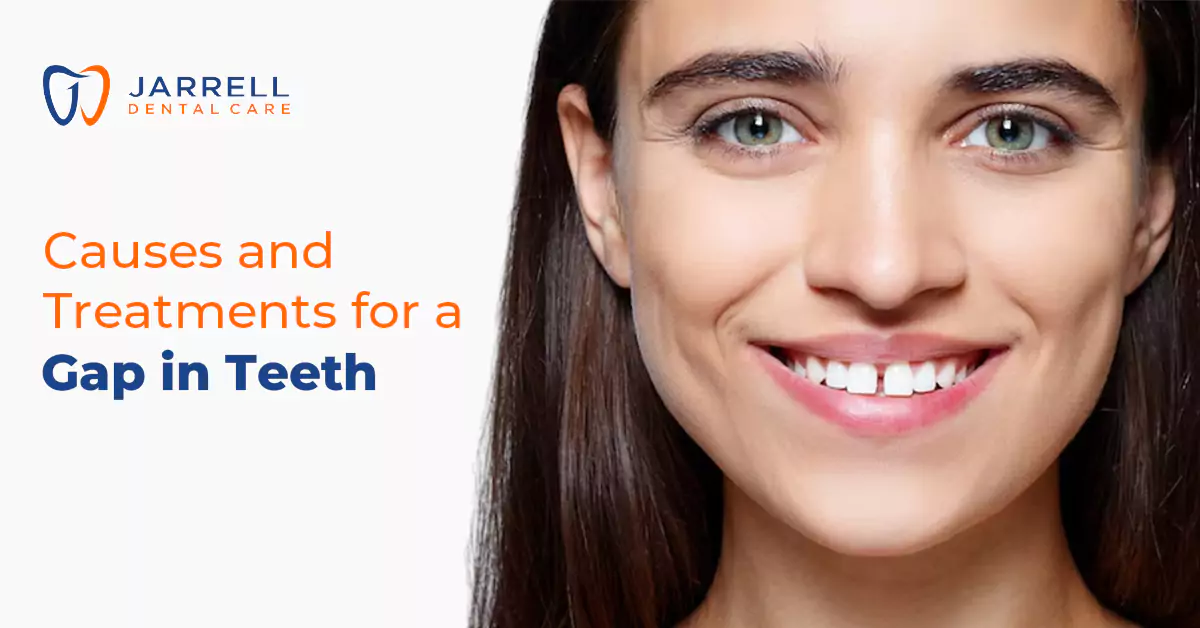 Cause and Treatment for a Gap in Teeth