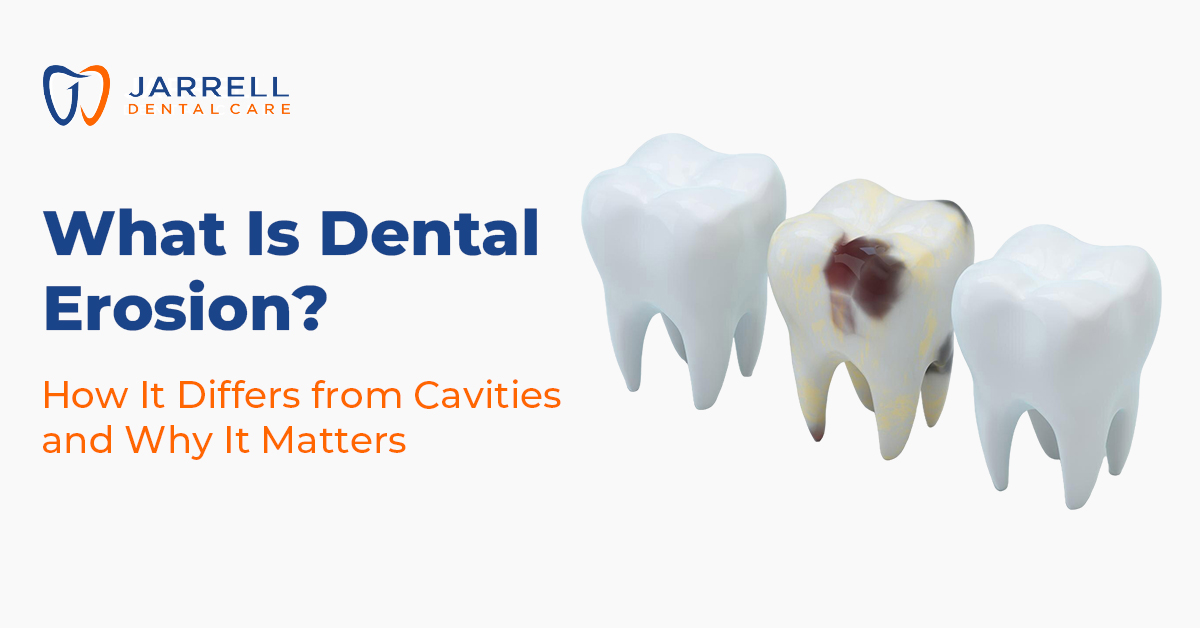 What Is Dental Erosion? How It Differs from Cavities and Why It Matters