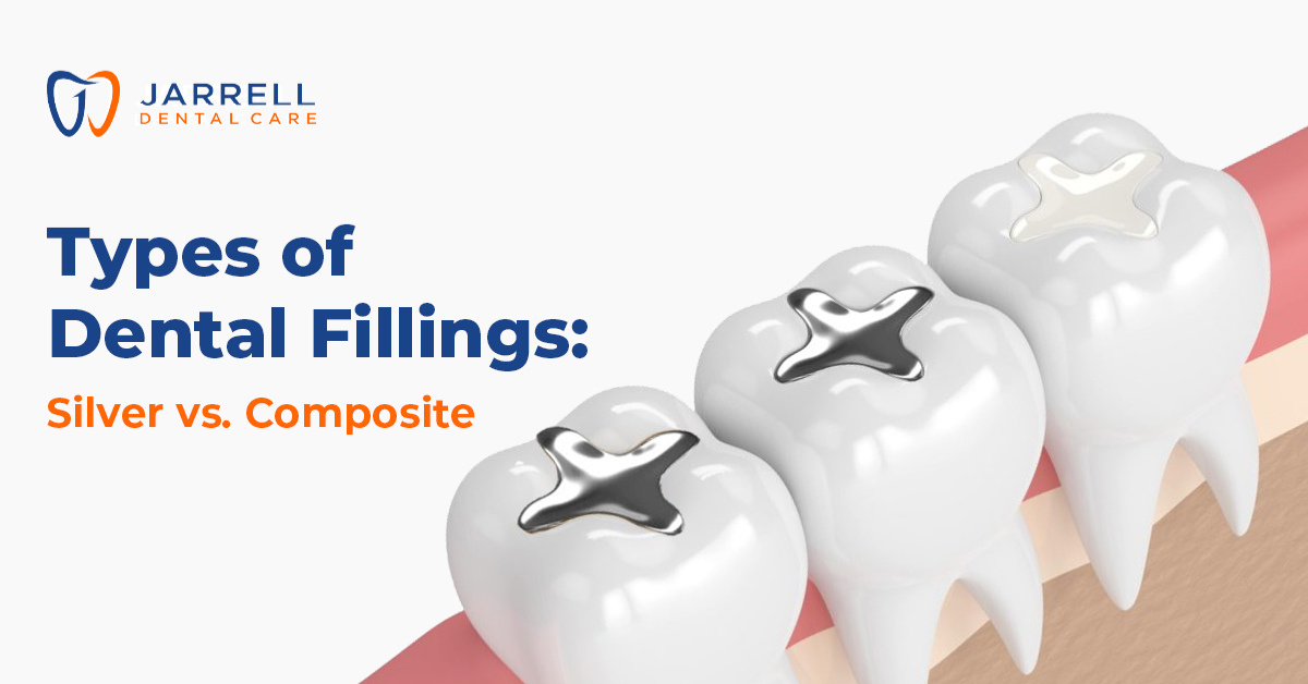 Types of Dental Fillings: Silver vs. Composite