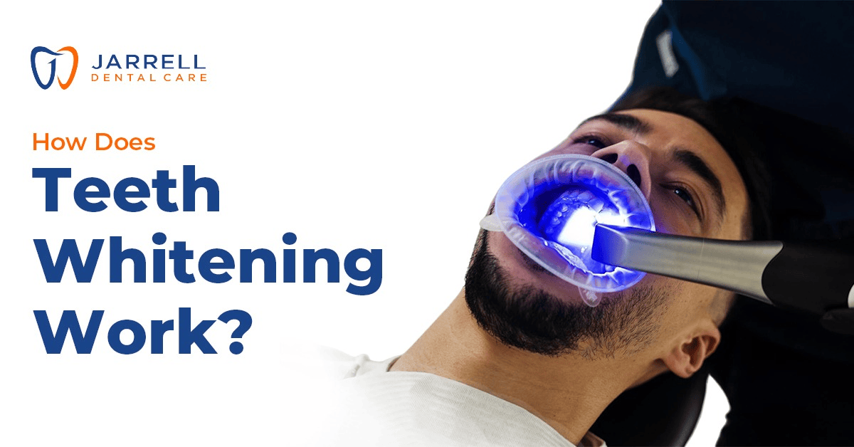 How Does Teeth Whitening Work?