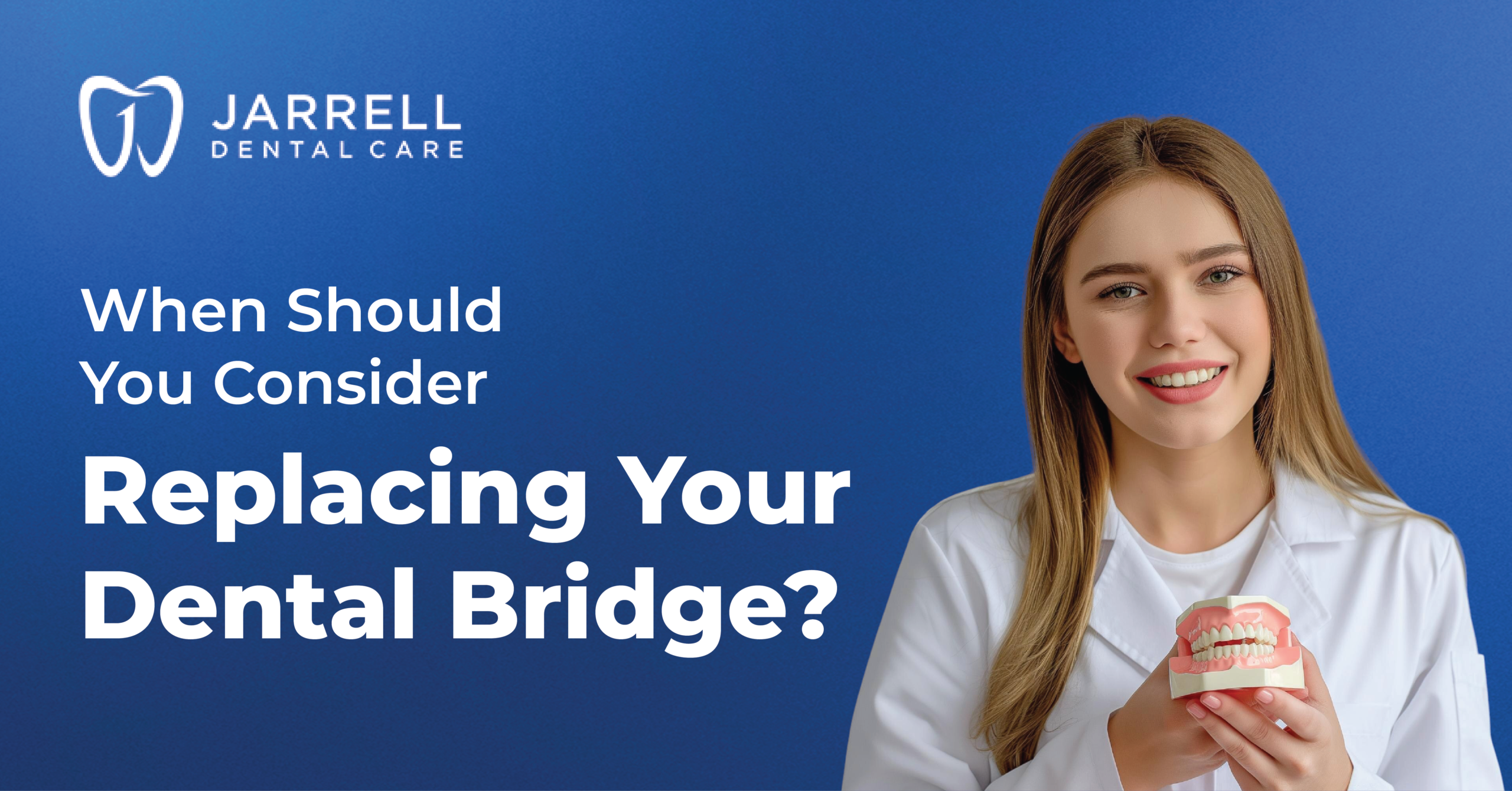 When Should You Consider Replacing Your Dental Bridge?