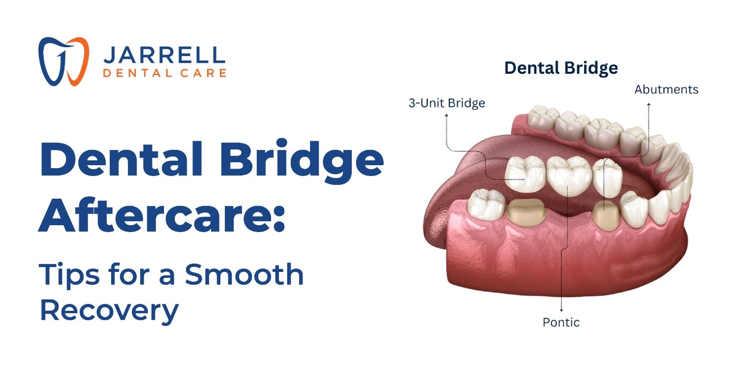 Dental Bridge Aftercare: Tips for a Smooth Recovery